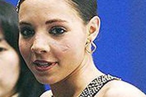 Ice Safe: Figure Skater Face Cut Risks & Prevention Learn to Surf & Skate: A Beginner's Step-by-Step Guide Ice Safe: Figure Skater Face Cut Risks & Prevention | Learn to Surf & Skate: A Beginner's Step-by-Step Guide